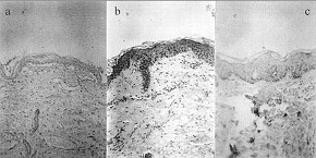 Fig. 2 - Histological sectoring: