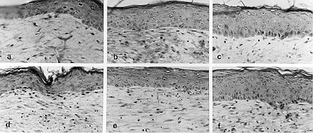 Fig. 2 - Structural organisation of the newly generated skin after homogencous and heterologous epidermal substitute grafting. Biopsy specimens were harvested 14 and 30 days postgrafting and stained using haematoxylin, phloxine and saffron staining method. Note the histological organization of the epidermis with a continuous basal cell layers, the stratum spinous, the stratum granular and the stratum corneum. We can also appreciate the formation of the neodermis. Magnification, X 250.