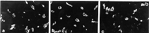 Fig. 5 - Tissue vascularization. Biopsy specimens were taken 14 days after grafting and stained with anti-CD31 monoclonal antibody. This staining showed immunoreactant deposition around vessels in the newly generated tissues after 50-50% (b) and 25-75% (c) heterologous implant grafting. Results were comparable to those obtained after homogeneous (a) implant grafting. Magnification: X 300. 