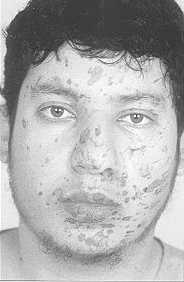 Fig. 2 - Immediately after tar removal