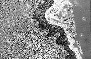 Fig. 7 - Case 3. Biopsy 5 days post-grafting on de-epidermidized homograft (stain ME), showing re-epithelialization. This was not visible macroscopically as differentiation was incomplete.