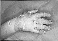 gr0000047.jpg (3994 byte)