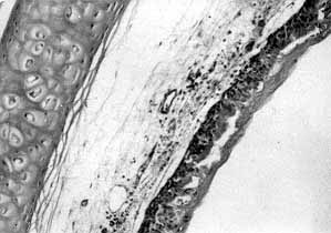 Fig. 3 - Twelve h post-injury, congestion, oedema, necroses and exfoliation of the tracheal mucosa were observed (HE x 200).