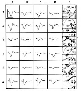 Fig. 2 - Influence of the bum shock on the evoked potentials of the diencephalon and midbrain structures.