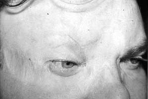 Fig. 17 - Final result of reconstruction.