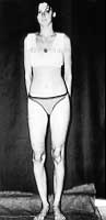 Fig. 20a - As in Fig. 20b. open knee joints.
