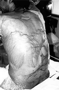 Fig. 6a - Case 2. Positive Nikol sky's sign.