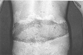 Fig. 4g - Final result.