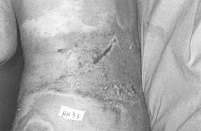 Fig. 4f - Appearance on day 8.