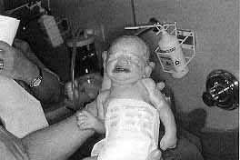 Fig. 3 - The living and viable foetus.