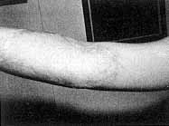 Fig. 4b - Result 8 months later.