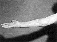 Fig. 5c - Result 6 months later.