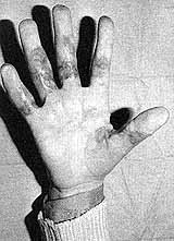 Fig. 7c - Result 6 months late