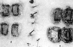 Fig. 4 - Comparative appearance of necrosis in delay flap (d) and normal skin (n).