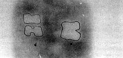 Fig. 6 - Autoradiography of the delay flap (d) versus normal skin (n). Note the marked distinct borders of the necrotic areas.