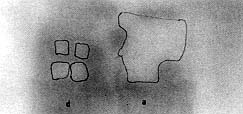 Fig. 11 - Autoradiography of a specimen in the phase 3 study. Note the marked distinct necrosis borders and extensive necrosis of the acute flap (a).