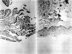 Fig. 2 - Histological sectioning: a) adult skin and b) secondary culture at least 30 days old. Note the basal layer marked CD29+ and the keratohyaline granules in intermediate layer cells and the most superficial cells.