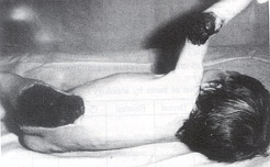 Fig. 1Apparence of child on admission