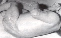 Fig. 2Apparence of child on discharge