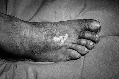 Fig. 10Post-graft results after 35 days.