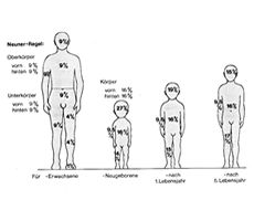 Fig. 2Cross-section of skin with diagram of normal skin section and measurement of depth in different degrees of burns.