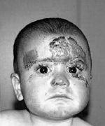 Fig. 2After ten days of treatment.