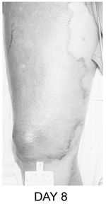 Fig. 9Patient #10.