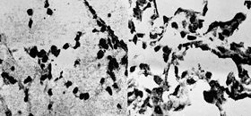 Fig. 1The change in expression of Fas antigen (Ag) in pulmonary tissue cells was up-regulated in scalded rats compared with control.