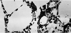 Fig. 2The change in expression of FasL antigen (Ag) in pulmonary tissue cells was up-regulated in scalded rats compared with control.