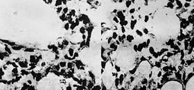 Fig. 3The change in expression of BCl-2 antigen (Ag) in pulmonary tissue cells was down-regulated in scalded rats compared with control.