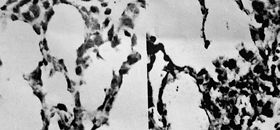 Fig. 4The change in expression of pulmonary tissue cellular NF- � B was manifestly up-regulated in scalded rats.
