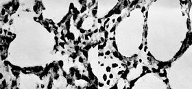 Fig. 5Changes in expression of pulmonary tissue cellular I � B in scalded rats. The expression of pulmonary tissue cellular I � B was manifestly down-regulated in scalded rats.