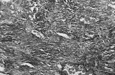 Fig. 1Existence of wound repair collagen on day 12. Score 3 (Trichrome x 100).