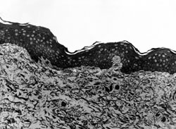 Fig. 1Structure of skin sample 6 h post mortem. Epidermis and dermis without visible alteration. In culture, keratinocytes produced multilayered epithelial sheet. Semi-thin section. Methylene blue, azure, basic fuchsin. Magnification x 750.