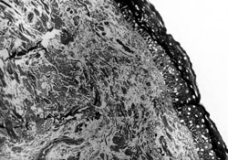 Fig. 3Structure of skin sample preserved at -70 �C in 199 medium with 10% glycerol and 10 ng/ml EGF for 30 days. Keratinocytes with lysed cytoplasm visible in all epidermal layers. Dermis without visible alterations. In culture, keratinocytes produced colonies in less than 50% of flask area. Semi-thin section. Methylene blue, azure, basic fuchsin. Magnification x 750.