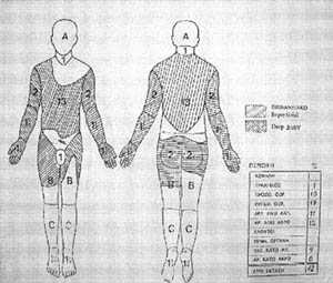 Fig. 1Burns chart