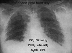 Fig. 2a