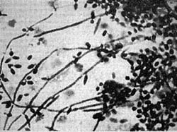 Fig. 4bClinical tests.