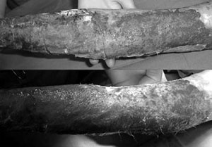 Fig. 13D Hyalograft on day 7 post-graft. Above: partly removed; below: completely removed.