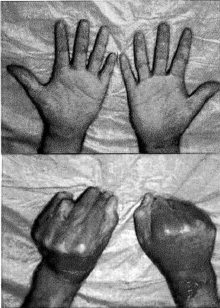 Fig. 4Functional outcome