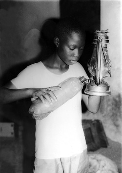 Fig. 1aThe common hurricane lantern used in Nigeria and the usual manoeuvre for refilling the lantern by holding it in the left hand.