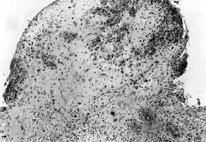 Fig. 1a