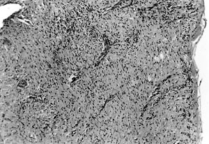 Fig. 2b
