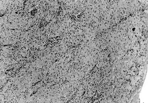 Fig. 3c