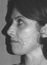 Fig. 2Same patient. View of face.
