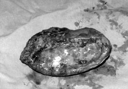 Fig. 2Spleen specimen.