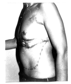 Fig. 3cThe same patient before the final stage of treatment.
