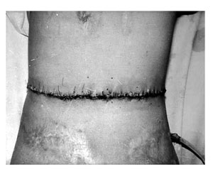 Fig. 6bShort-term result of the operation.