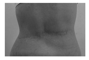 Fig. 6cResult of operation afetr 10 years.