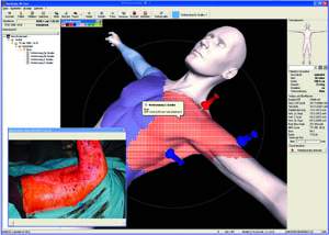 Fig. 4User Interface of BurnCase 3D Core.
